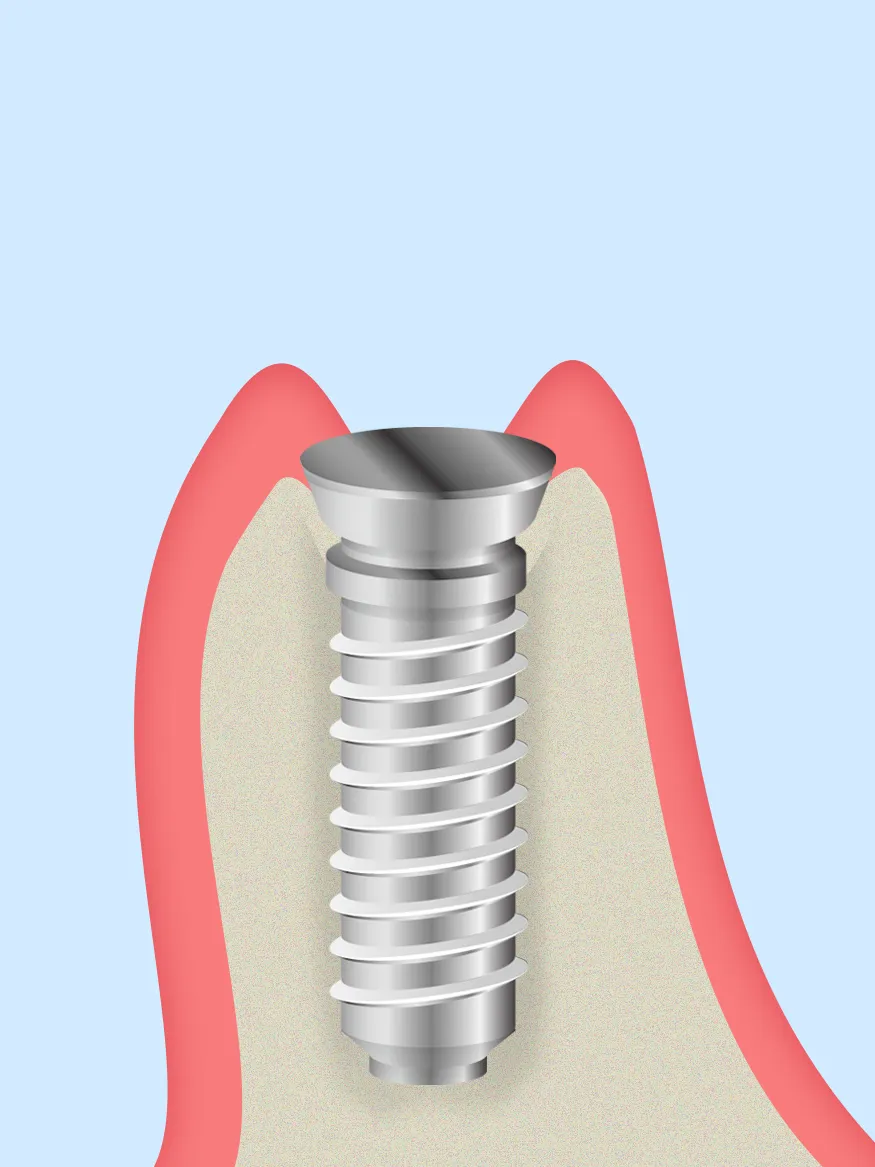 ステップ3